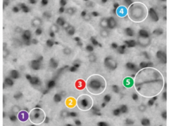 Machine Learning Algorithm Beats Human Experts At Detecting Microscopic Radiation Damage