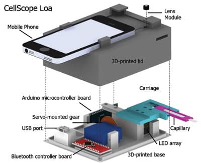 cellscope-loa-smartphone-parasite-blood
