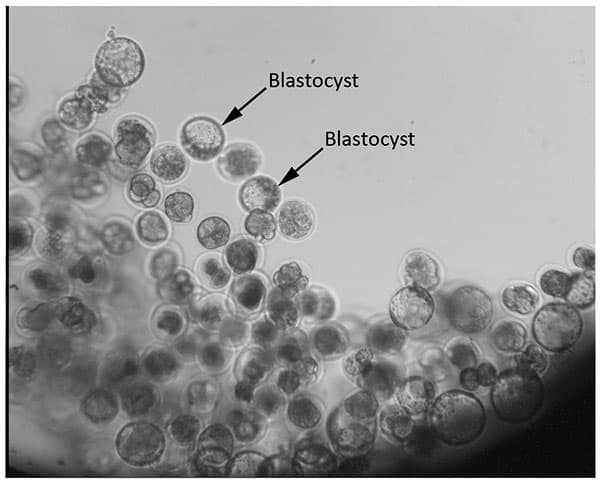 Blastocyst