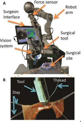 Robotic_arm_soft_tissue_operation