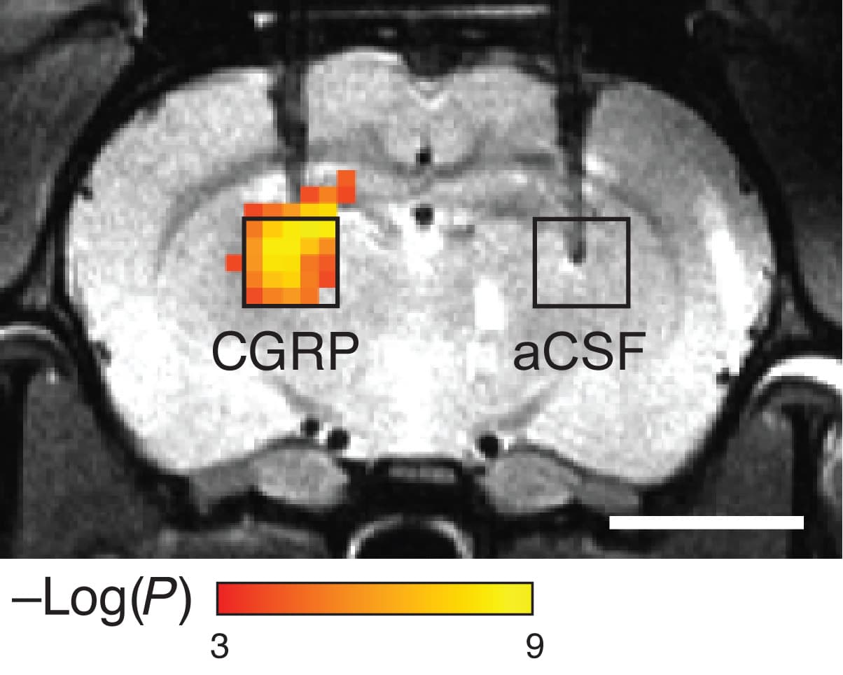 MIT_MRI_Imaging