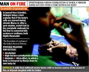 In-rare-condition-Tamil-Nadu-infant-keeps-catching-fire